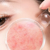 Skin Barrier Care