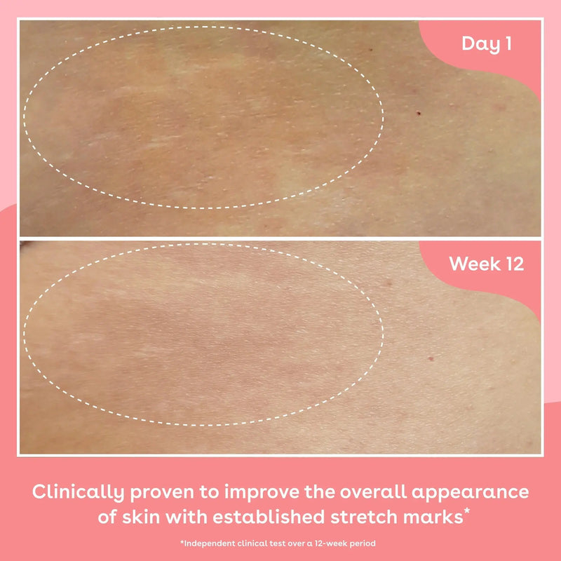 Q+A Collagen Body Oil