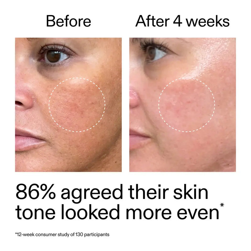 The Inkey List Starter Retinol Serum