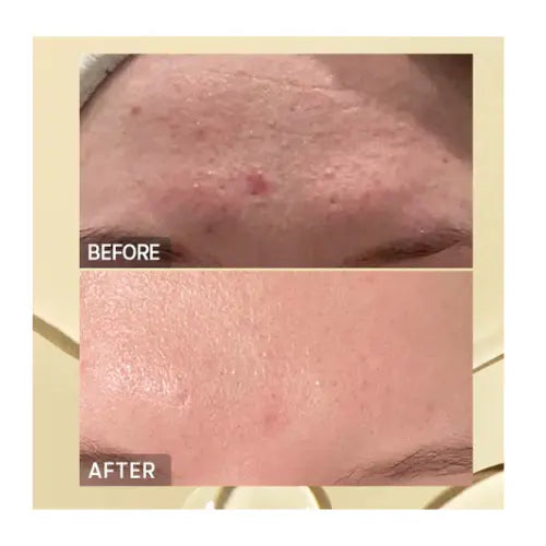 COSRX Advanced Snail96 Mucin Power Essence 30 ml.