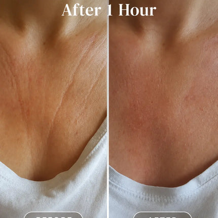 Apricot Beauty Décolleté Pad Hyaluron