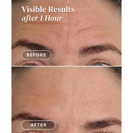Apricot Beauty Forehead Pad Ectoin