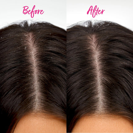 Brushworks Scalp Detox Comb