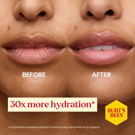 Burt's Bees Lip Balm Ultra Conditioning