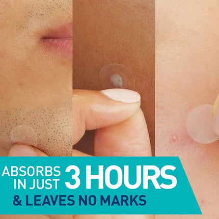 CeraVe Anti-Blemish Patches