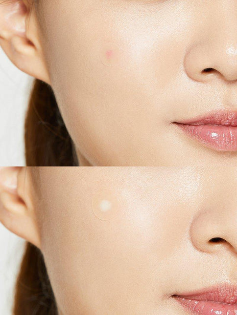 COSRX Acne Pimple Master Patch Original Fit