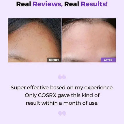 COSRX Bha/Aha Clarifying Treatment Toner 30 ml.