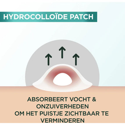 Garnier PureActive Pimple Patch