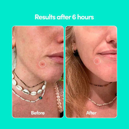 Merci Handy Donut Button Patches