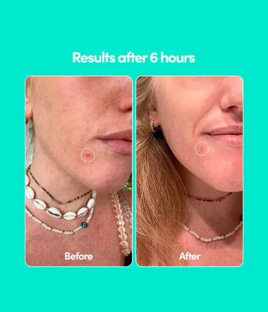 Merci Handy Donut Button Patches