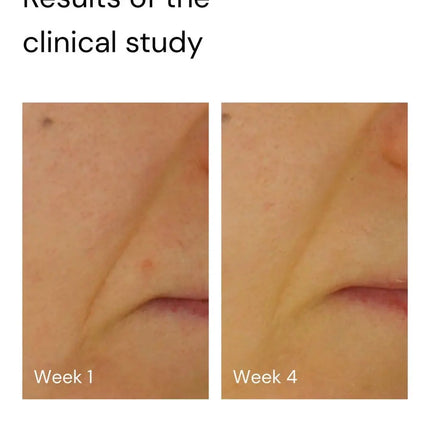 Merme Berlin Super Stable C Face Serum 30 ml.