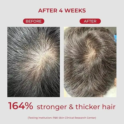 Moev Annurcatin Shampoo