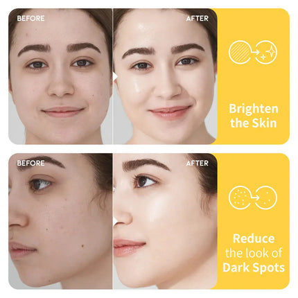 OOTD Dark Spot Vitamin C Toner Pad