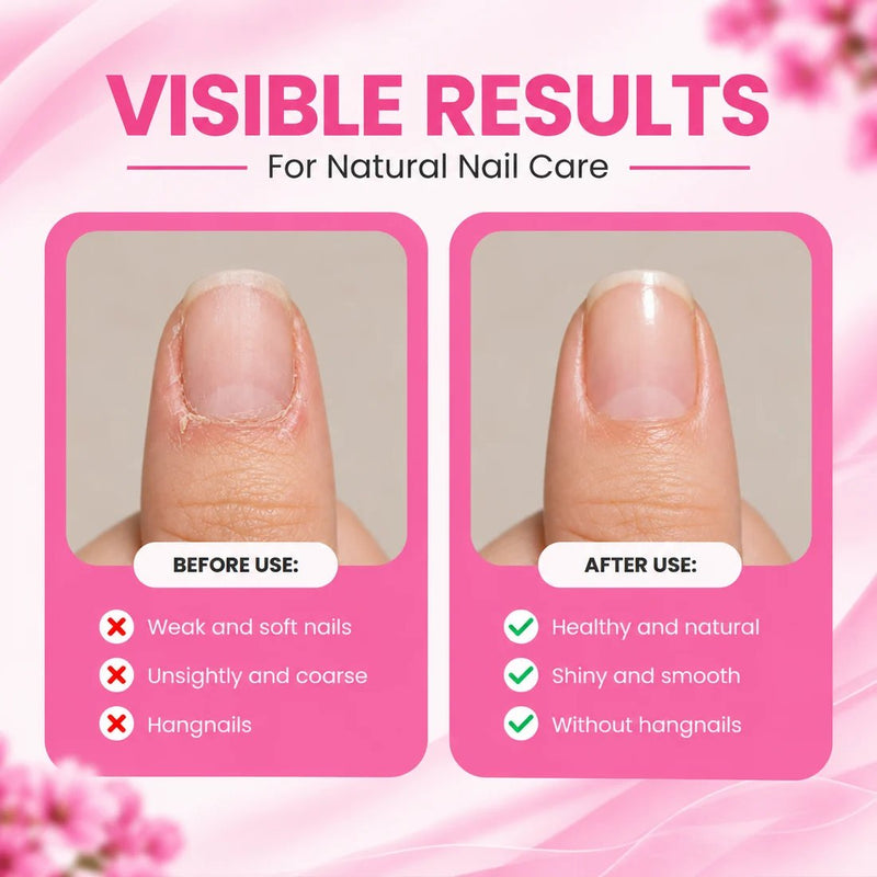 Secret Nails Secret Nail Care Pen Cuticle Oil, verzorgende nagelriemolie in penvorm, foto 3 van 6