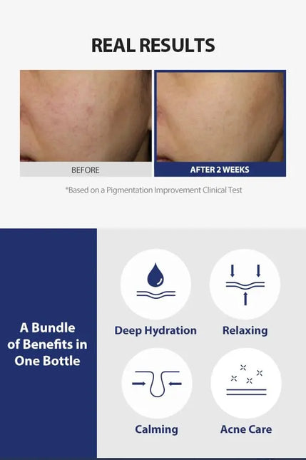 Sungboon Editor Centell Lacto AC Less Skin Barrier Essence