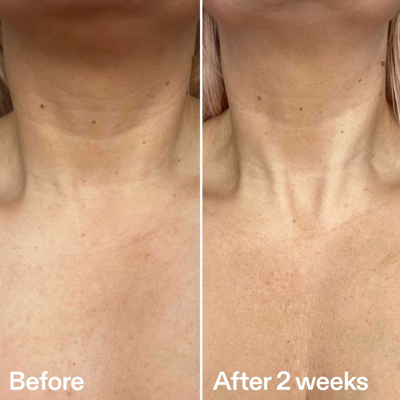 The Inkey List Bio Active Ceramide Neck Stick
