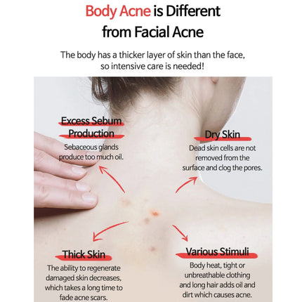 TIA'M Anti-blemish Body Lotion