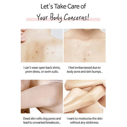 TIA'M Anti-blemish Body Lotion