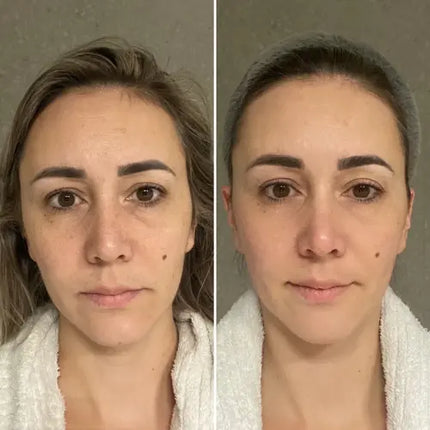 Bbody Tripeptide Collagen